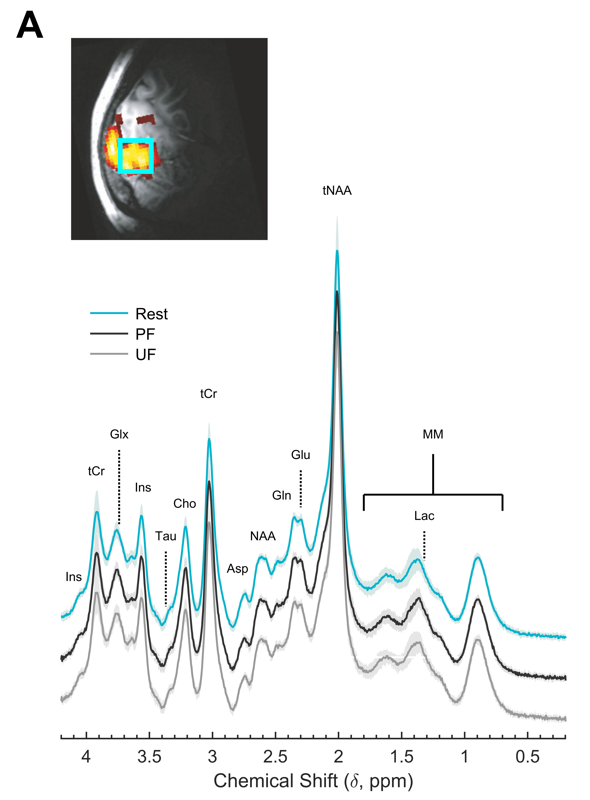 Frontiers  Automated Skull Stripping in Mouse Functional Magnetic  Resonance Imaging Analysis Using 3D U-Net