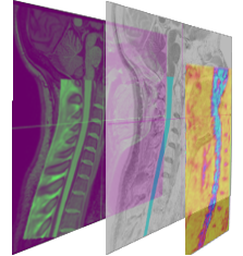 spinalcord